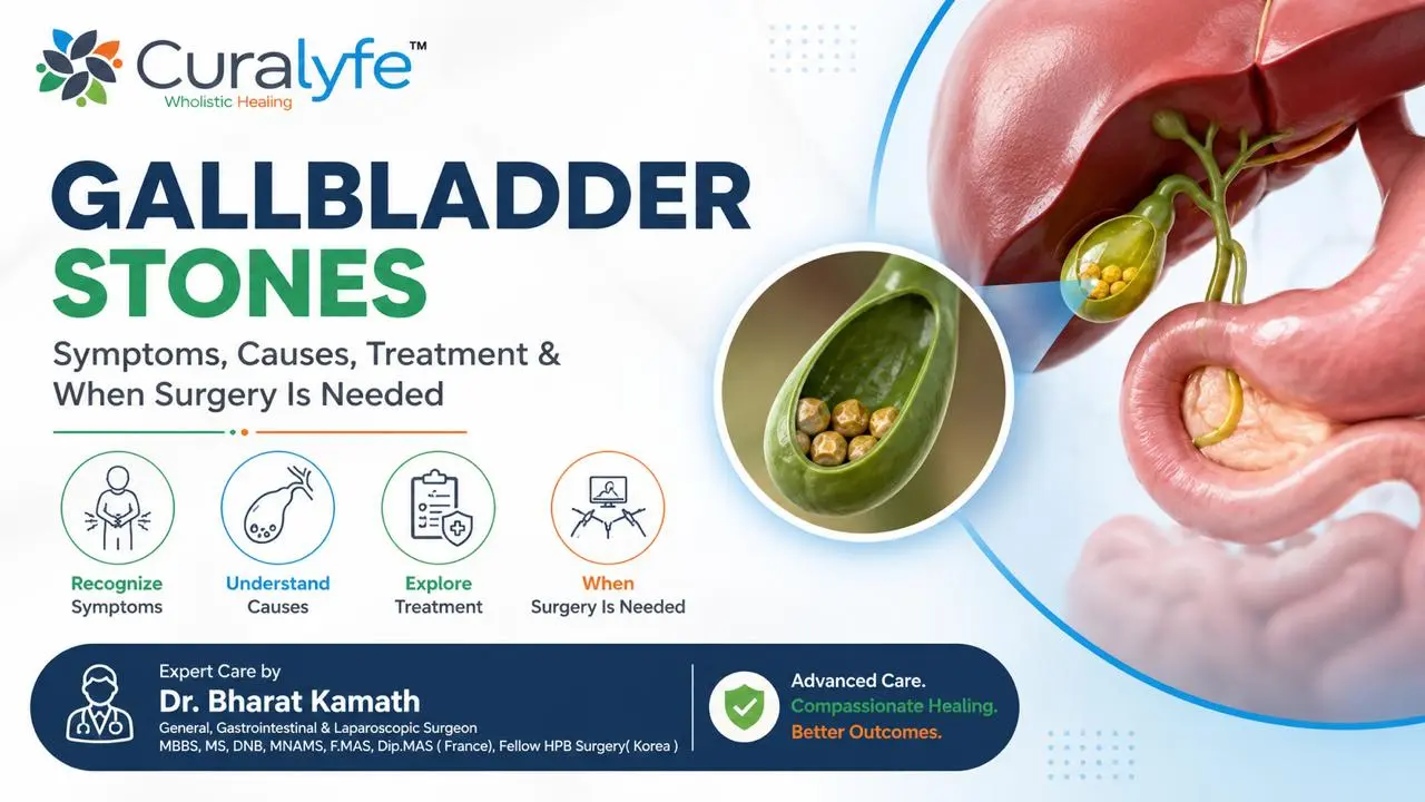 Gallbladder Stones: Symptoms, Causes, Treatment & When Surgery Is Needed